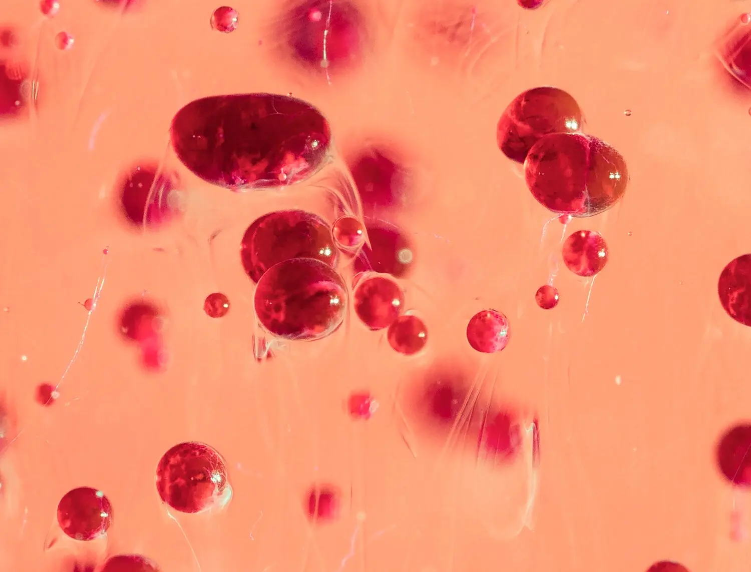 Markers of diabetic nephropathy FIA Test Kits